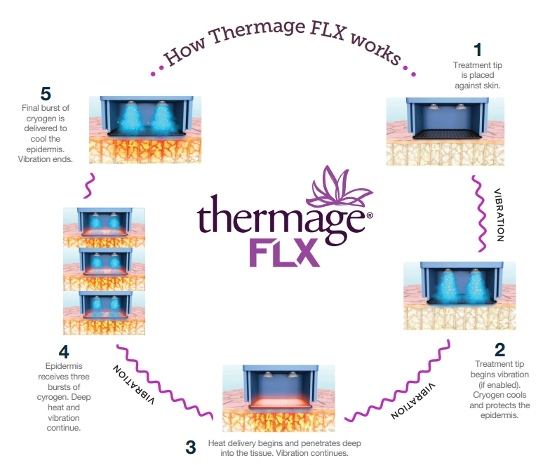 รู้ก่อนตัดสินทำ Thermage FLX เทคโนโลยียกกระชับผิวแบบไร้แผล Thermage FLX คืออะไร ? Thermage FLX ช่วยแก้ปัญหาอะไรบ้าง ? ข้อดีของ Thermage FLX ? Thermage FLX ราคา ? Thermage เชียงรายมีไหม ? เทอมาจ เชียงราย ทำที่ไหนดี ?