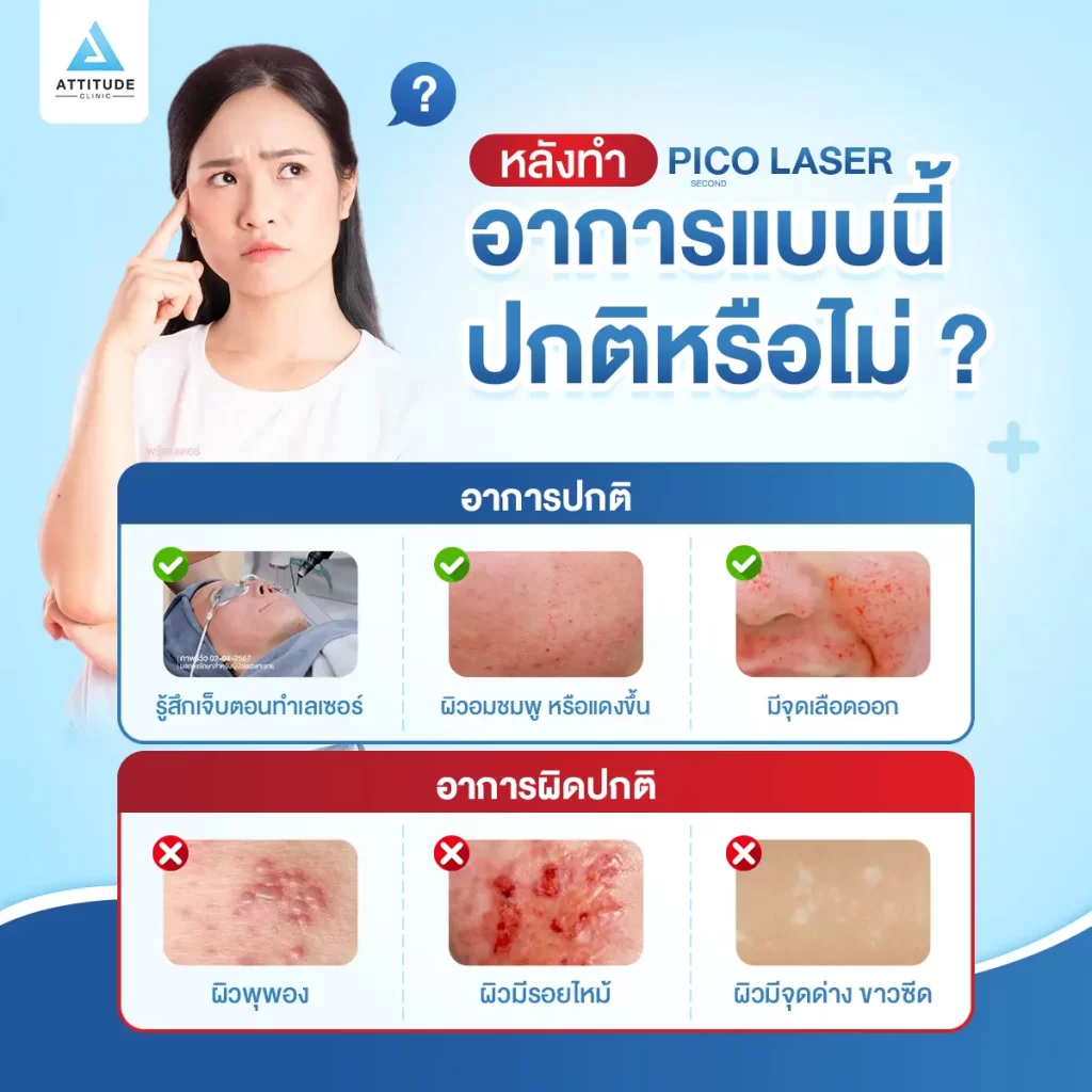 แอททิจูดพาไขความลับ ทำ Picosecond Laser ต้องรู้อะไรบ้าง