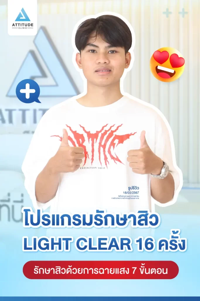 รีวิวรักษาสิวน้องบอส ด้วยการฉายแสง Light Clear 7 ขั้นตอน จำนวน 16 ครั้ง รักษาสิวอักเสบ สิวอุดตัน และรอยสิวทั่วใบหน้าที่ Attitude Clinic