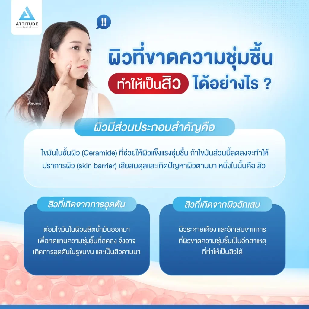 มอยส์เจอร์ไรเซอร์ Step เตรียมผิวง่ายๆ ช่วยลดโอกาสเป็นสิว