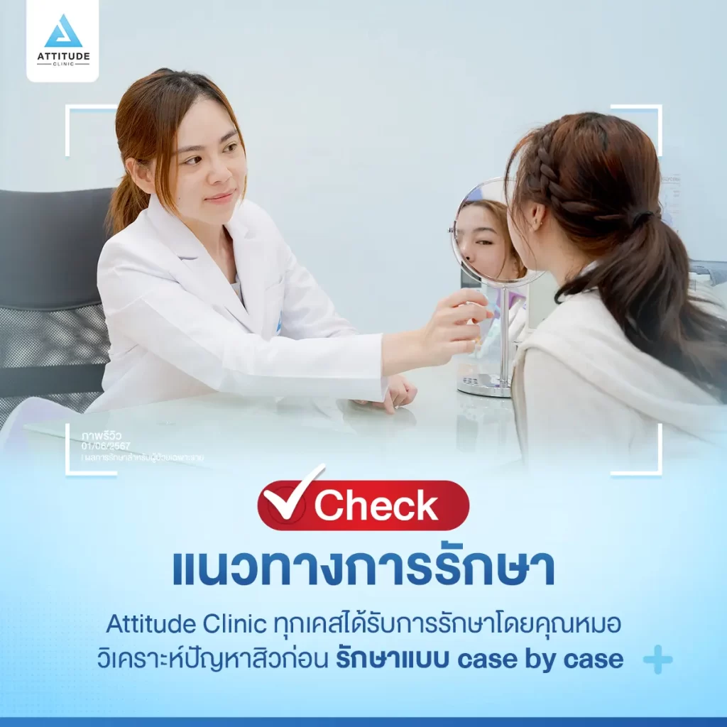 5 Checklist อยากสิวหายต้องเลือกยังไงก่อนตัดสินใจรักษา ?