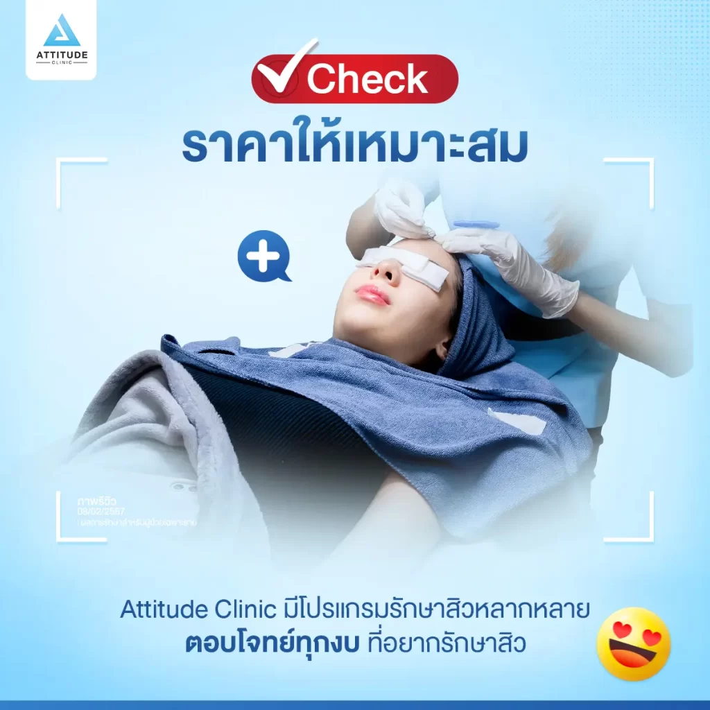 5 Checklist อยากสิวหายต้องเลือกยังไงก่อนตัดสินใจรักษา ?