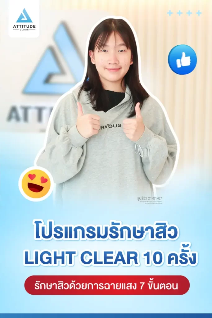 รีวิวรักษาสิวน้องตุ๊กตา ด้วยการฉายแสง Light Clear 7 ขั้นตอน จำนวน 10 ครั้ง รักษาสิวฮอร์โมน สิวอักเสบ สิวอุดตันเม็ดเล็กๆ รอยแดงทั่วใบหน้า โดยเฉพาะ 2 ข้างแก้ม และคางที่ Attitude Clinic