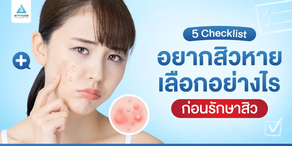 5 Checklist อยากสิวหายต้องเลือกยังไงก่อนตัดสินใจรักษา ?