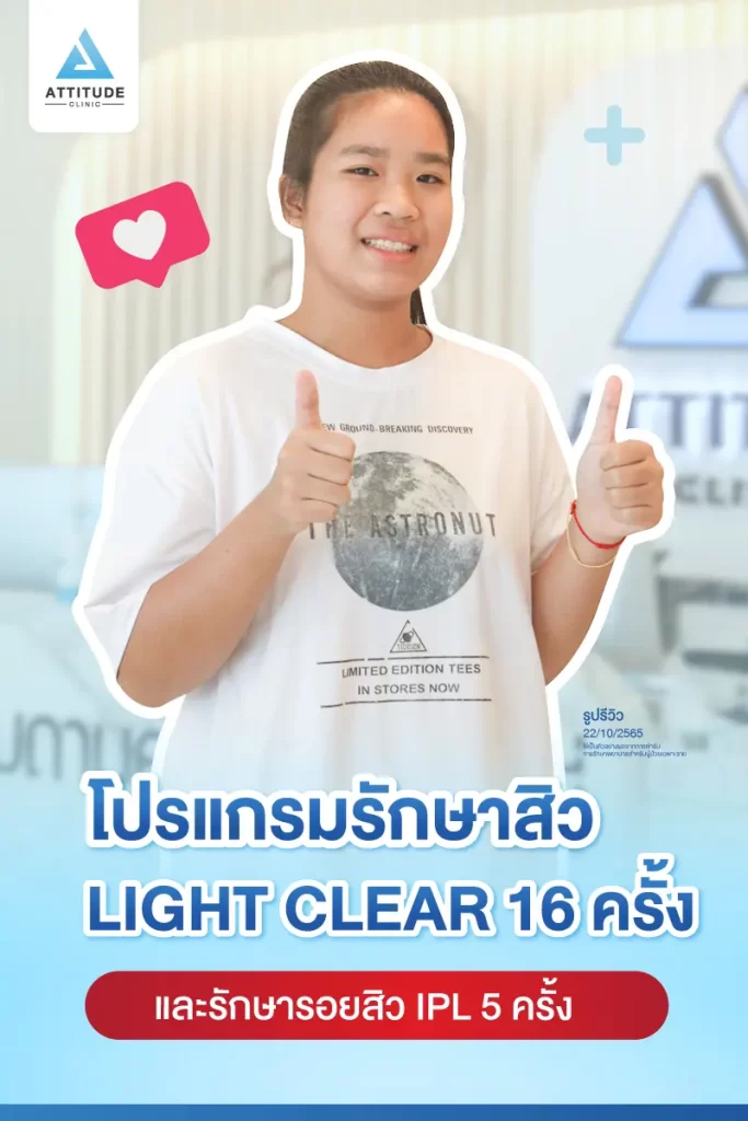 รีวิวรักษาสิวน้องณัฐชารีย์ ด้วยการฉายแสง Light Clear 7 ขั้นตอน จำนวน 16 ครั้ง และทำ IPL หน้าใส ลดรอยสิว จำนวน 5 ครั้ง รักษาสิวสิวอุดตัน สิวผดเม็ดเล็กๆ ทั่วใบหน้า และลำคอที่ Attitude Clinic