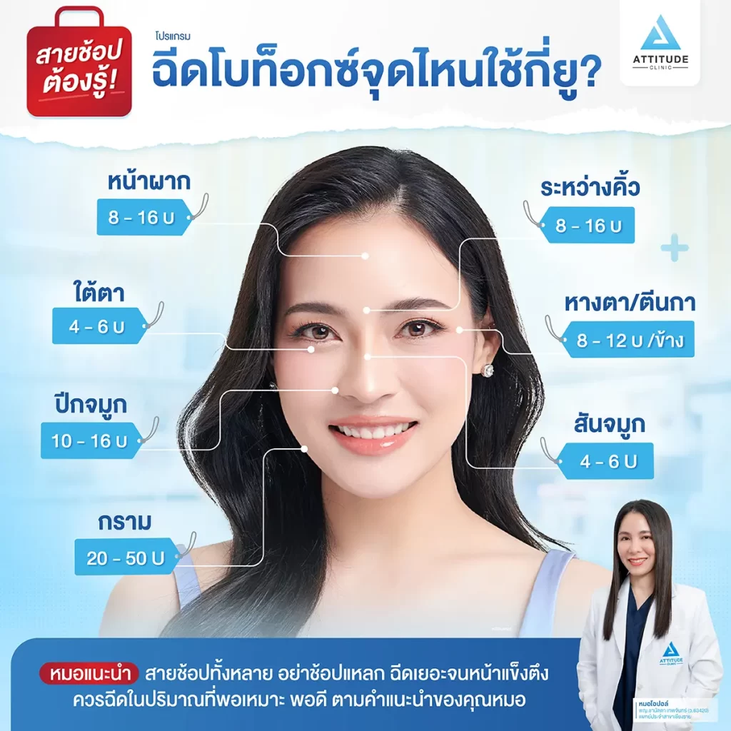 ฉีดจุดไหนใช้กี่ยูนิต สายช้อปต้องรู้!! เลือกให้ถูกจุดก่อนตัดสินใจฉีดโปรแกรมโบท็อกซ์ ลดเลือนริ้วรอย ปรับรูปหน้า ลดขนาดกล้ามเนื้อกราม