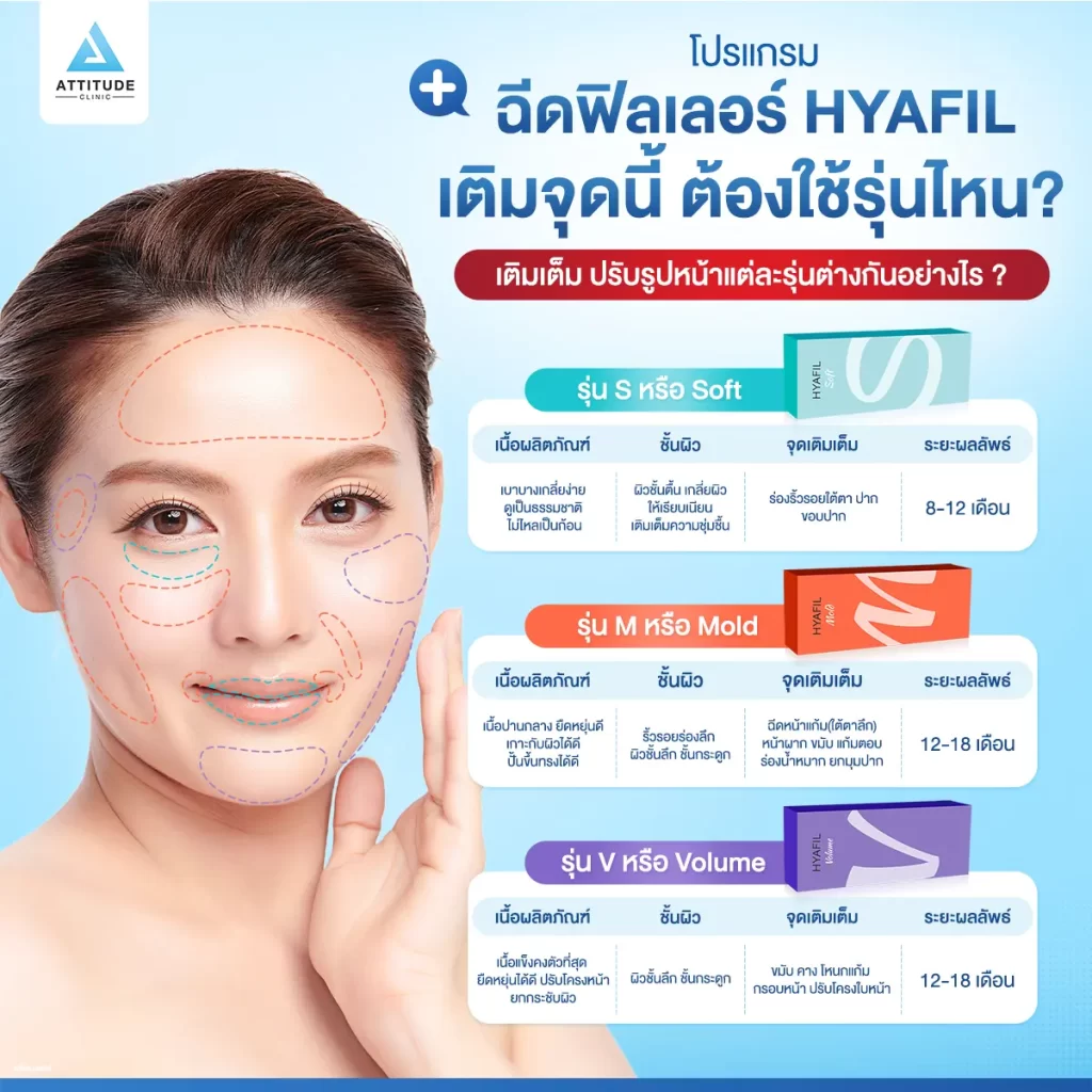 โปรแกรมฉีดฟิลเลอร์ Hyafilia เติมจุดนี้ ต้องใช้รุ่นไหน? เติมเต็ม ปรับรูปหน้าแต่ละรุ่นต่างกันอย่างไร ?​