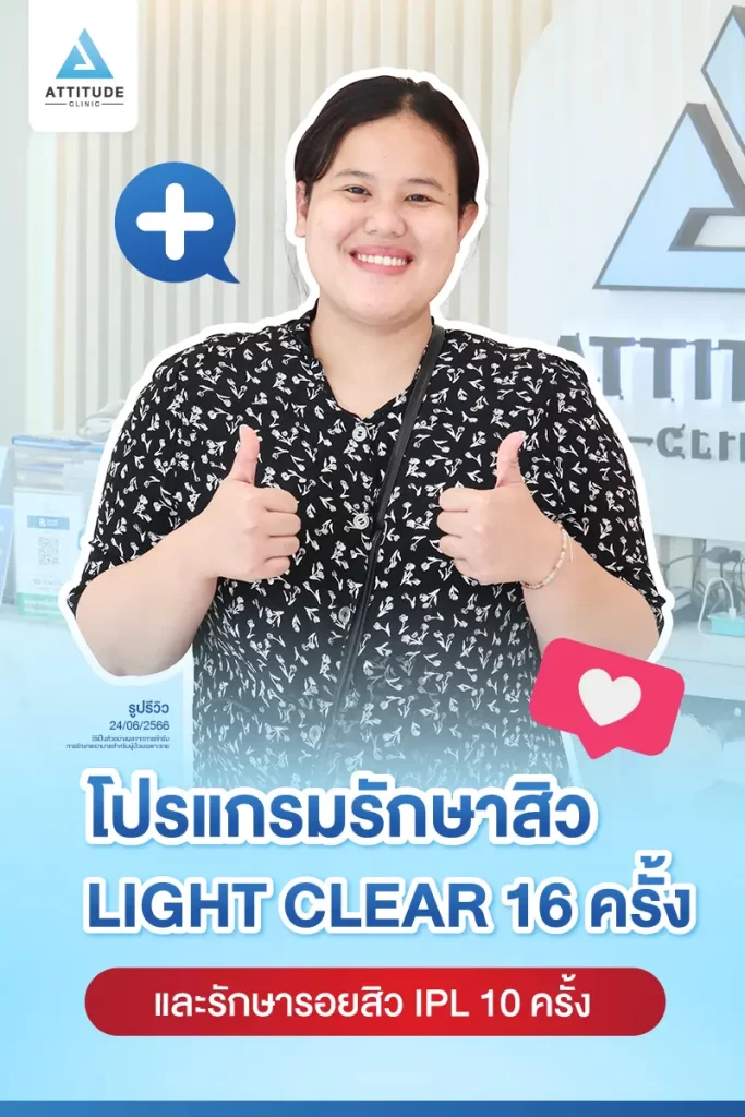 รีวิวรักษาสิวคุณนุ่น ด้วยการฉายแสง โปรแกรมรักษาสิว Light Clear 7 ขั้นตอน จำนวน 16 ครั้ง และโปรแกรม IPL หน้าใส จำนวน 10 ครั้ง รักษาสิวอักเสบ สิวอุดตัน และรอยแดงสิวทั่วใบหน้าที่ Attitude Clinic