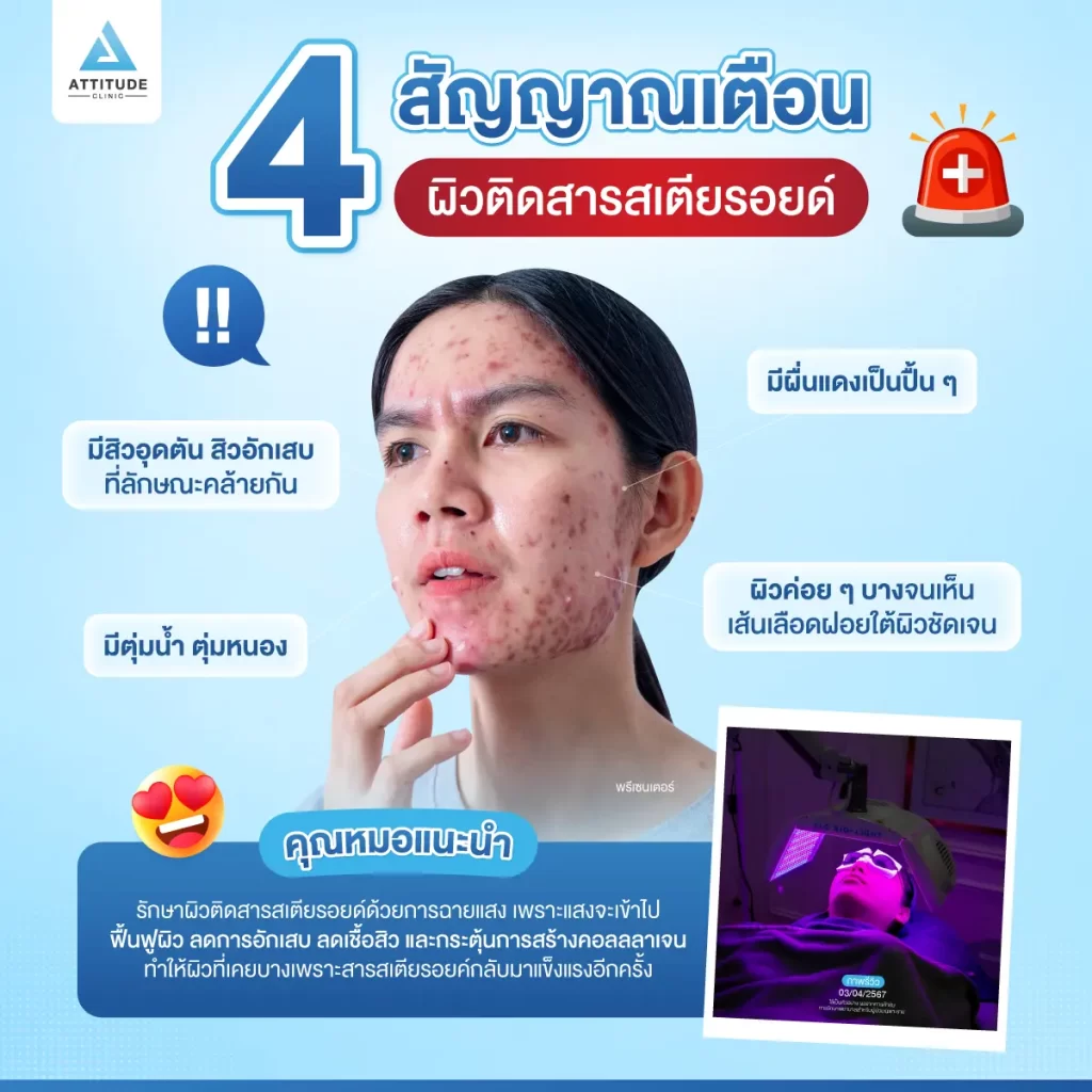 4 สัญญาณเตือนว่าผิวติดสารสเตียรอยด์