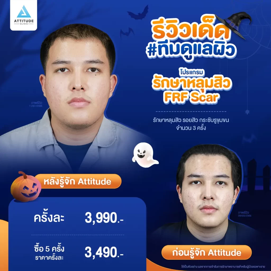 ห้ามพลาด! ถ้าอยากเฉิดฉายในปาร์ตี้ Halloween แอททิจูดมัดรวมรีวิวเด็ด #ทีมดูแลผิว พร้อมปาร์ตี้ทั้งคืนก็ไม่หวั่น