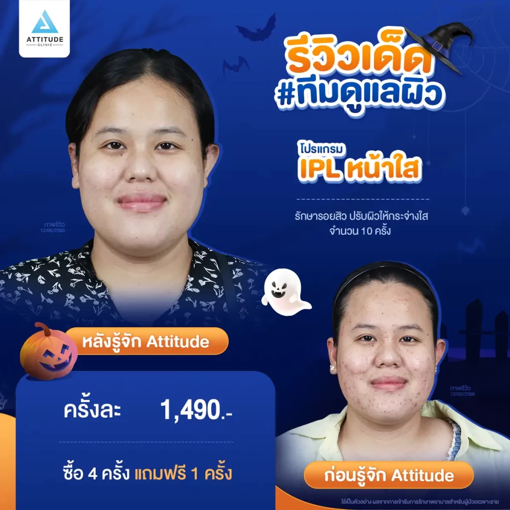 ห้ามพลาด! ถ้าอยากเฉิดฉายในปาร์ตี้ Halloween แอททิจูดมัดรวมรีวิวเด็ด #ทีมดูแลผิว พร้อมปาร์ตี้ทั้งคืนก็ไม่หวั่น