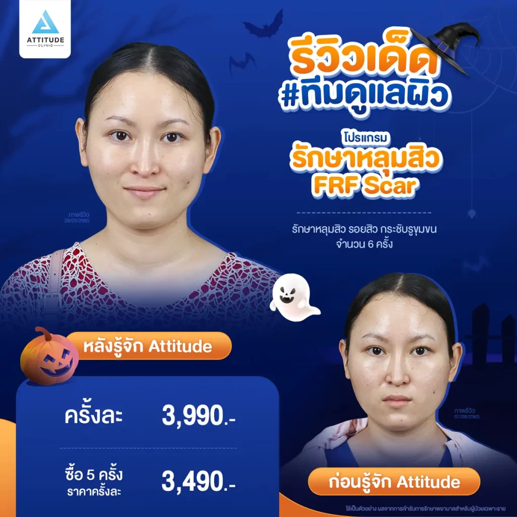 ห้ามพลาด! ถ้าอยากเฉิดฉายในปาร์ตี้ Halloween แอททิจูดมัดรวมรีวิวเด็ด #ทีมดูแลผิว พร้อมปาร์ตี้ทั้งคืนก็ไม่หวั่น