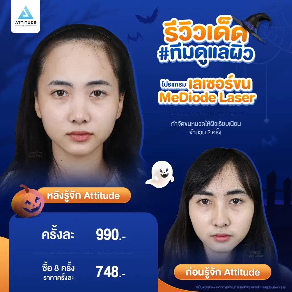 ห้ามพลาด! ถ้าอยากเฉิดฉายในปาร์ตี้ Halloween แอททิจูดมัดรวมรีวิวเด็ด #ทีมดูแลผิว พร้อมปาร์ตี้ทั้งคืนก็ไม่หวั่น