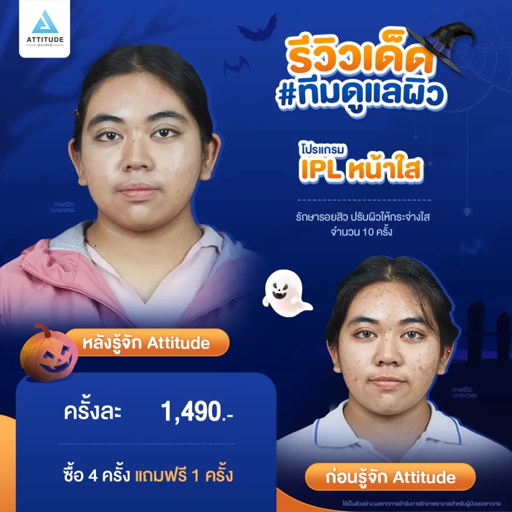 ห้ามพลาด! ถ้าอยากเฉิดฉายในปาร์ตี้ Halloween แอททิจูดมัดรวมรีวิวเด็ด #ทีมดูแลผิว พร้อมปาร์ตี้ทั้งคืนก็ไม่หวั่น