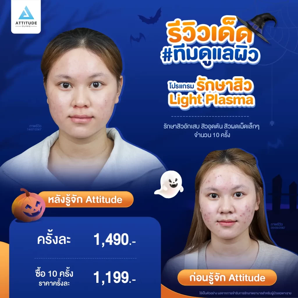 ห้ามพลาด! ถ้าอยากเฉิดฉายในปาร์ตี้ Halloween แอททิจูดมัดรวมรีวิวเด็ด #ทีมดูแลผิว พร้อมปาร์ตี้ทั้งคืนก็ไม่หวั่น