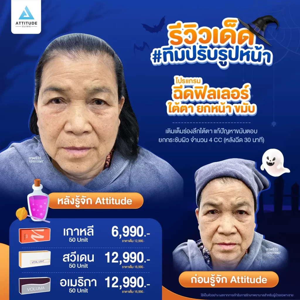 ไม่เป็นอีกแล้ว!! ตัวตลกในปาร์ตี้ Halloween แอททิจูดมัดรวมรีวิวเด็ด #ทีมปรับรูปหน้า หันมุมไหนก็รอดตลอดปาร์ตี้