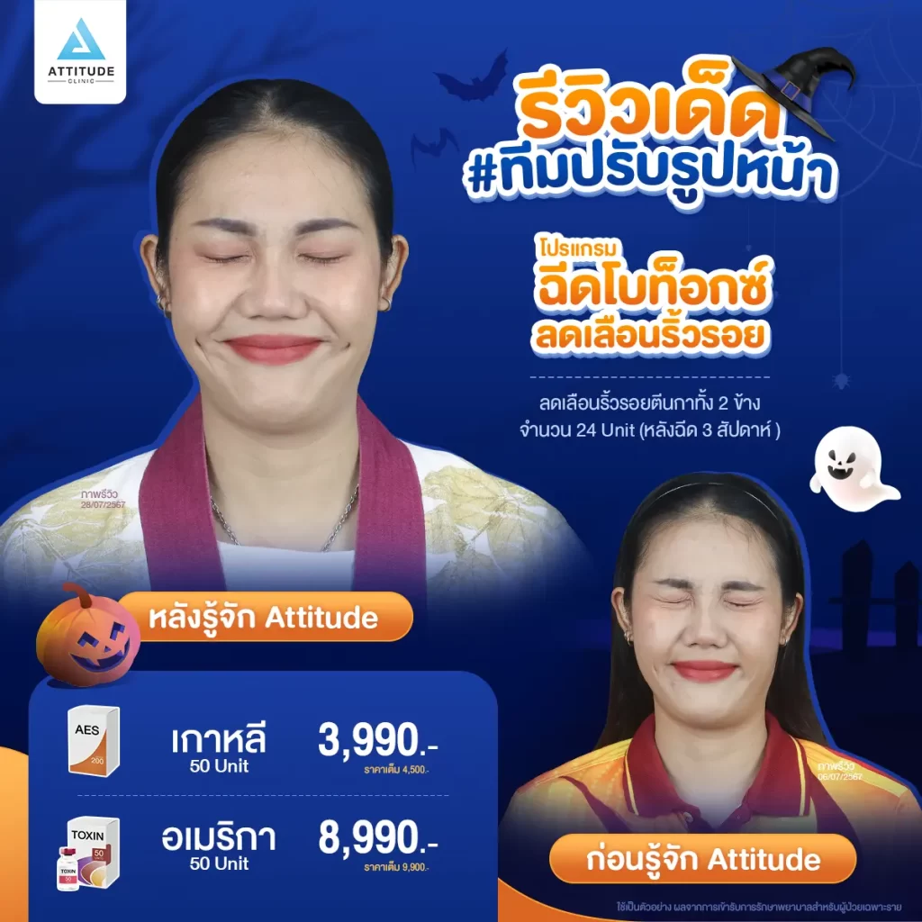 ไม่เป็นอีกแล้ว!! ตัวตลกในปาร์ตี้ Halloween แอททิจูดมัดรวมรีวิวเด็ด #ทีมปรับรูปหน้า หันมุมไหนก็รอดตลอดปาร์ตี้