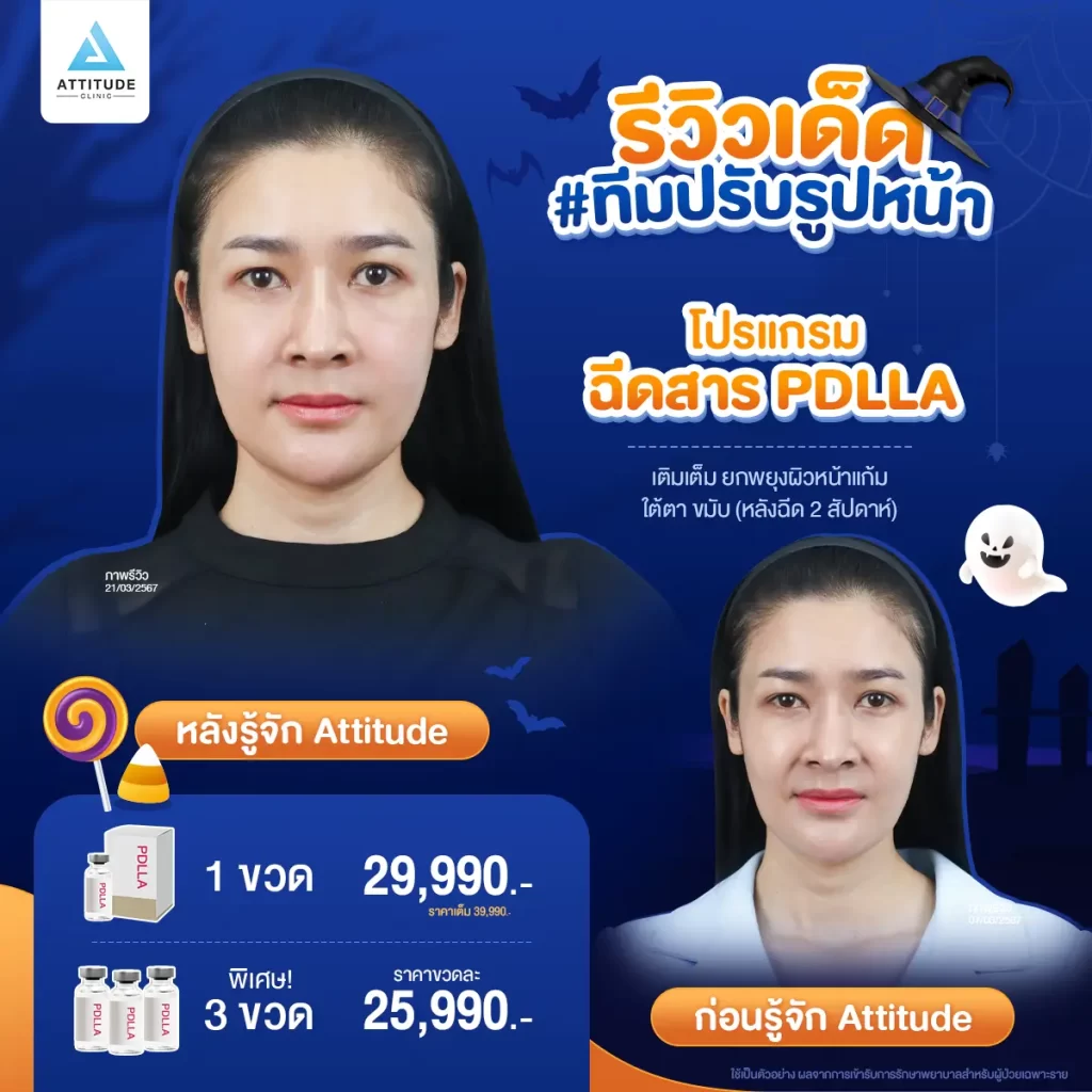 ไม่เป็นอีกแล้ว!! ตัวตลกในปาร์ตี้ Halloween แอททิจูดมัดรวมรีวิวเด็ด #ทีมปรับรูปหน้า หันมุมไหนก็รอดตลอดปาร์ตี้