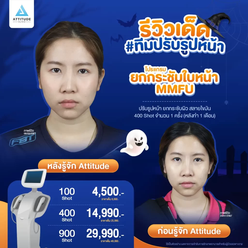 ไม่เป็นอีกแล้ว!! ตัวตลกในปาร์ตี้ Halloween แอททิจูดมัดรวมรีวิวเด็ด #ทีมปรับรูปหน้า หันมุมไหนก็รอดตลอดปาร์ตี้