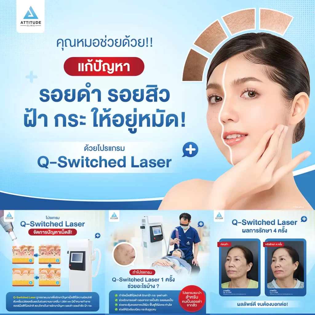 พร้อมออกเที่ยว แต่ผิวหน้ามีปัญหา! ต้องให้คุณหมอช่วยดูแล รักษารอยดำ รอยสิว ฝ้า กระ ด้วย Q-Switched Laser เครื่องได้มาตรฐาน หมอดูแลเองทุกเคส ได้ผลลัพธ์หลังทำเป็นที่น่าพอใจ จนต้องบอกต่อ!