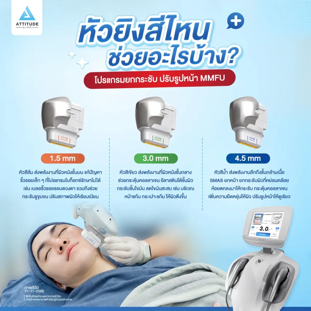 ยกกระชับ ปรับรูปหน้า โปรแกรม MMFU ส่งพลังงานคลื่น Focused Ultrasound ความถี่เข้มข้นลงลึกถึงชั้น SMAS ชั้นที่ใช้สำหรับการศัลยกรรมดึงหน้า ให้เกิดการหดตัวและยกกระชับขึ้นมาโดยไม่ผ่าตัด ไม่เกิดรอยแผล