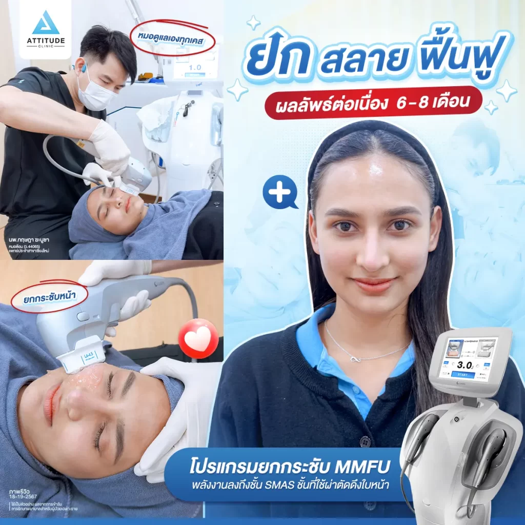 ยก สลาย ฟื้นฟู โปรแกรม MMFU ส่งพลังงานคลื่น Focused Ultrasound ความถี่เข้มข้นลงลึกถึงชั้น SMAS ชั้นที่ใช้สำหรับการศัลยกรรมดึงหน้า ให้เกิดการหดตัวและยกกระชับ ลดเลือนริ้วรอย สลายไขมันส่วนเกินโดยไม่ผ่าตัด ไม่เกิดรอยแผล