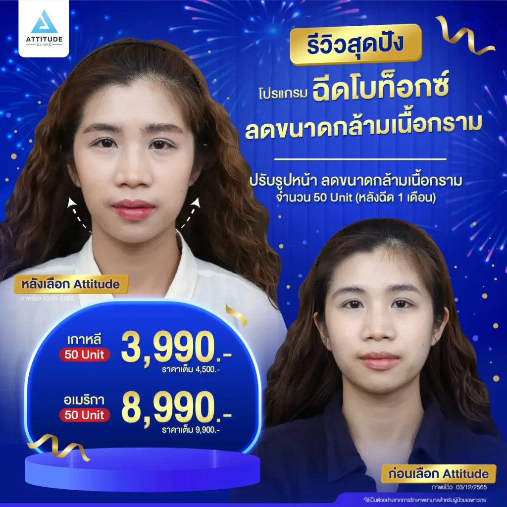 รวมรีวิวโปรแกรมฉีดโบท็อกซ์สุดปัง หน้าเรียว หน้าตึงแบบนี้ต้องฉีดโปรแกรมโบท็อกซ์กี่ยูนิต ??