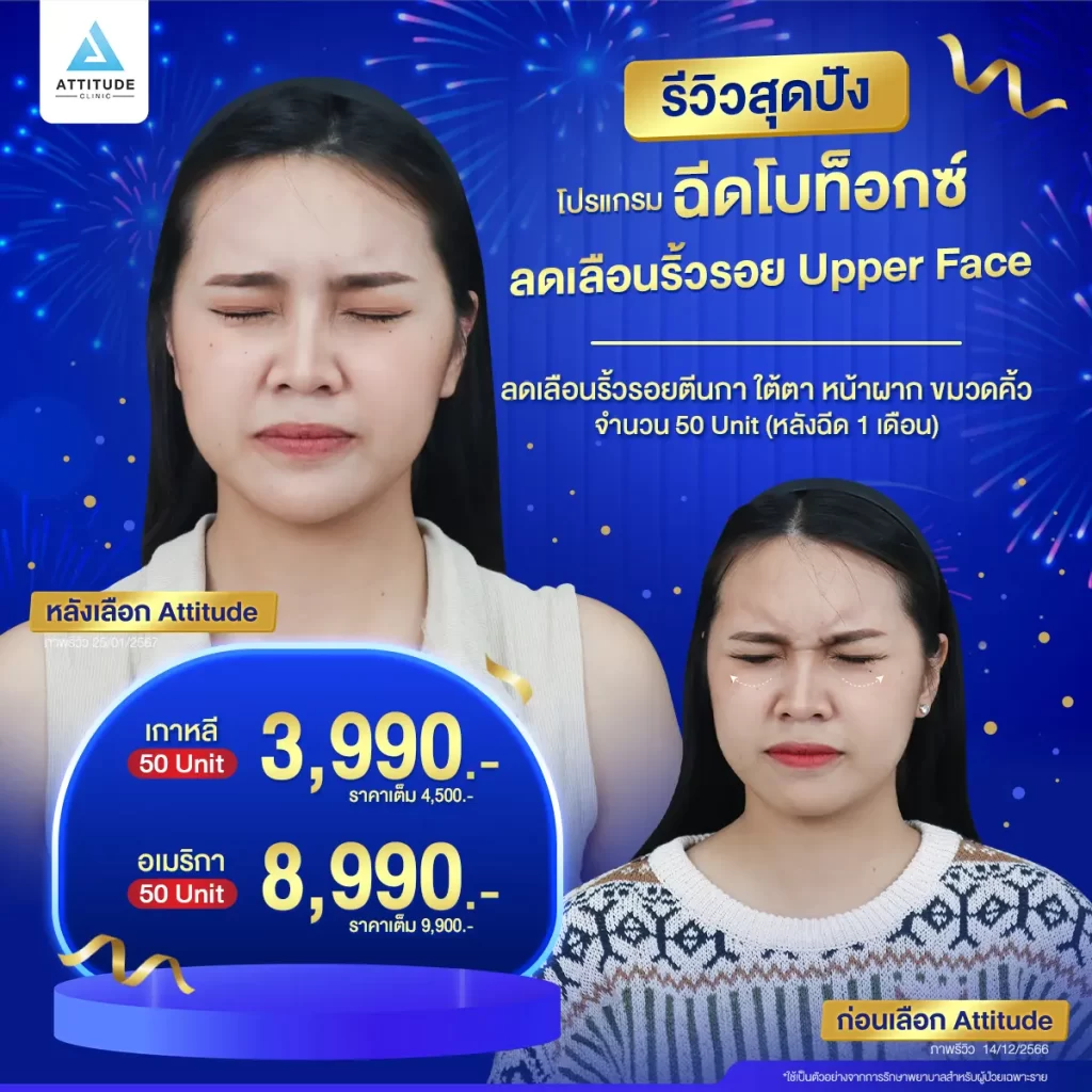 รวมรีวิวโปรแกรมฉีดโบท็อกซ์สุดปัง หน้าเรียว หน้าตึงแบบนี้ต้องฉีดโปรแกรมโบท็อกซ์กี่ยูนิต ??