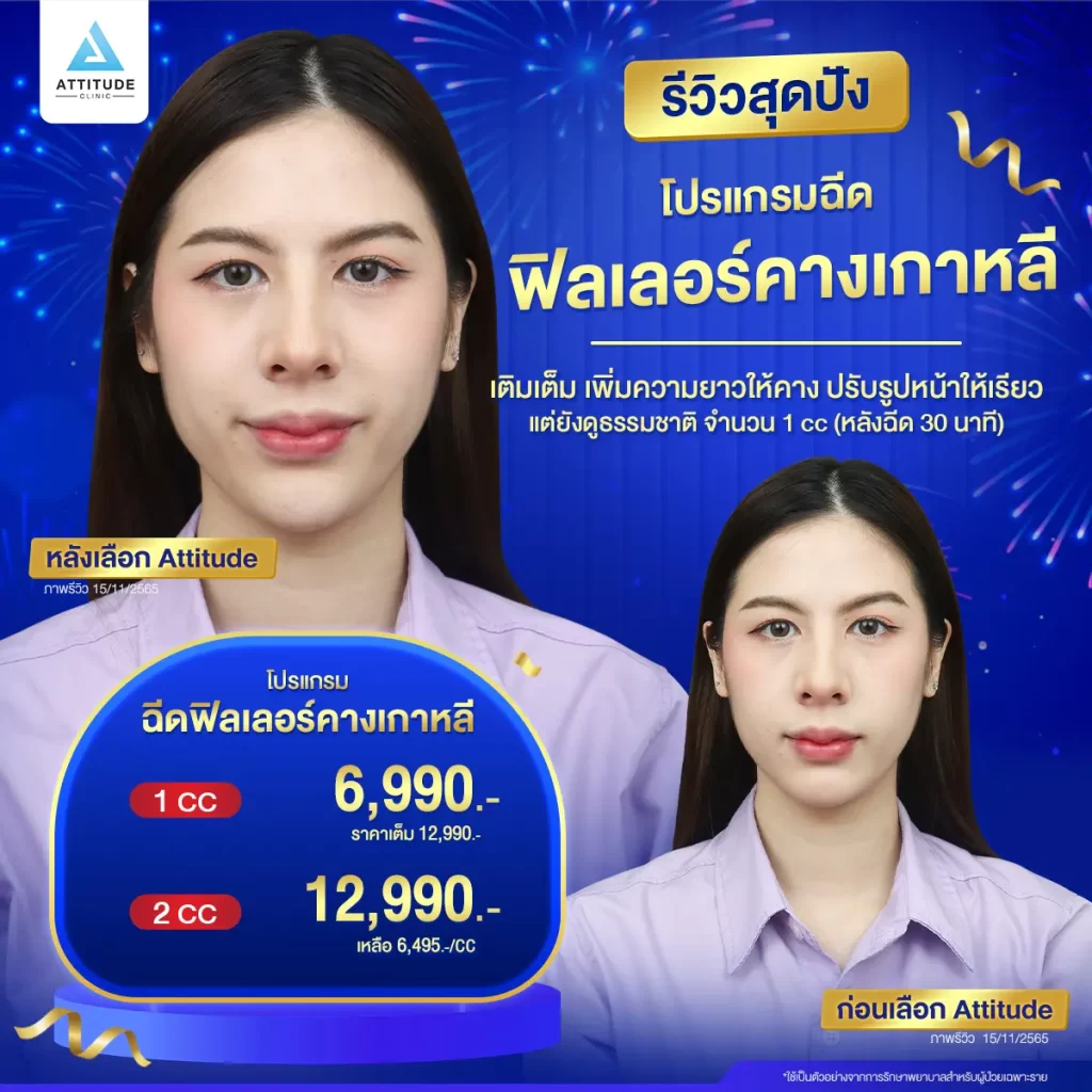 รวมรีวิวโปรแกรมฉีดฟิลเลอร์คางสุดปัง หมดปัญหากวนใจ เลิกสงสัยทำไมหน้าไม่เรียว