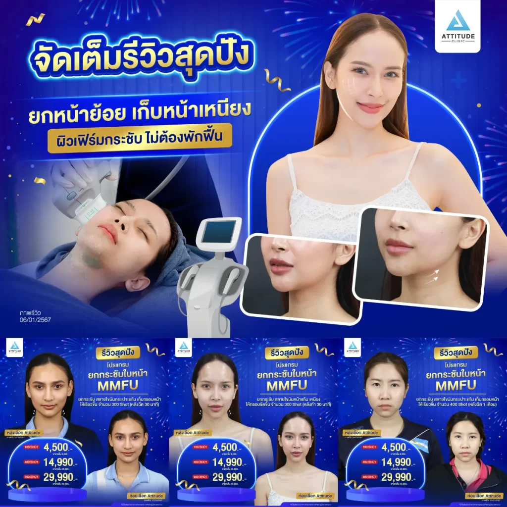 รวมรีวิวโปรแกรมยกกระชับใบหน้า MMFU สุดปัง ยกหน้าย้อย เก็บหน้าเหนียง ผิวเฟิร์มกระชับไม่ต้องพักฟื้น