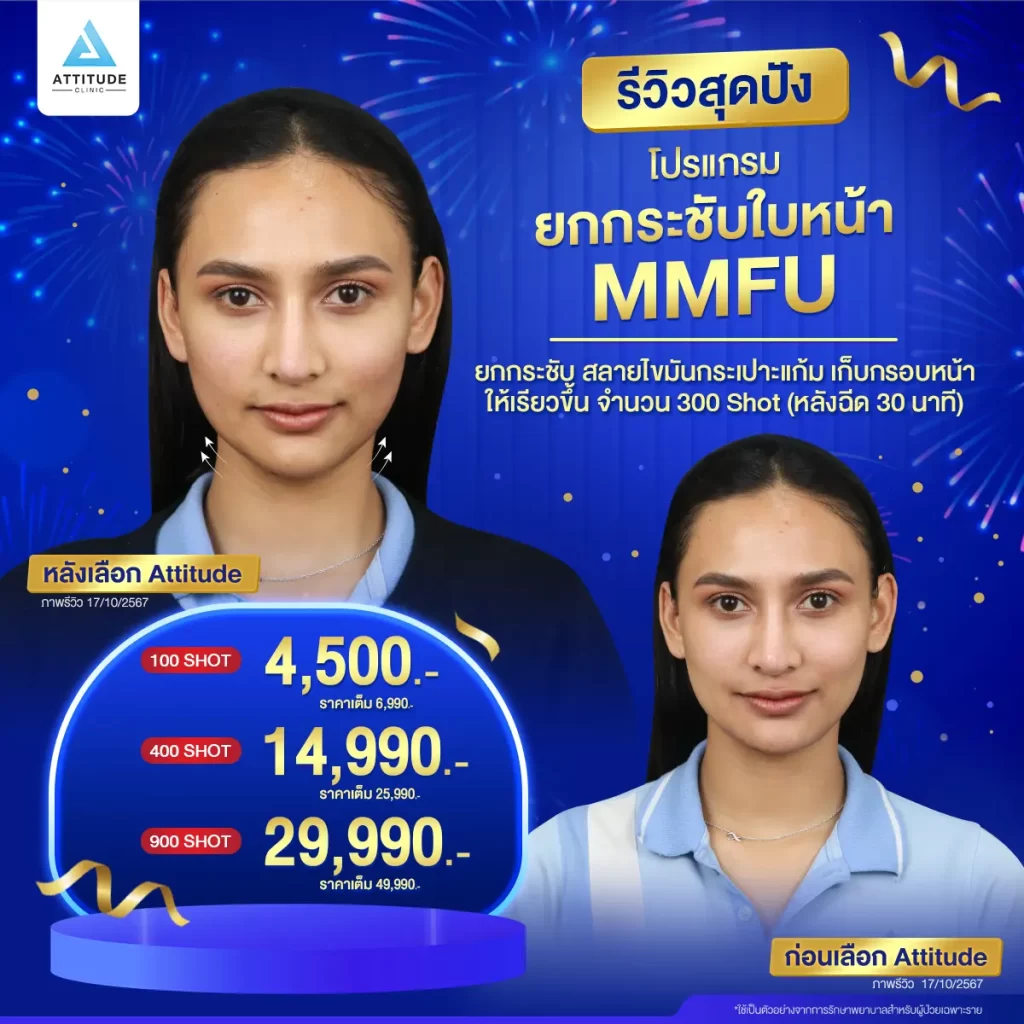 รวมรีวิวโปรแกรมยกกระชับใบหน้า MMFU สุดปัง ยกหน้าย้อย เก็บหน้าเหนียง ผิวเฟิร์มกระชับไม่ต้องพักฟื้น