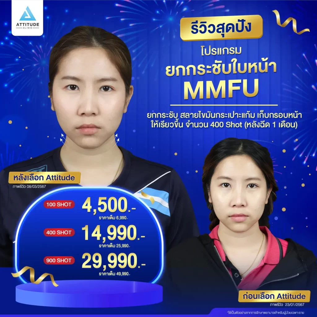 รวมรีวิวโปรแกรมยกกระชับใบหน้า MMFU สุดปัง ยกหน้าย้อย เก็บหน้าเหนียง ผิวเฟิร์มกระชับไม่ต้องพักฟื้น